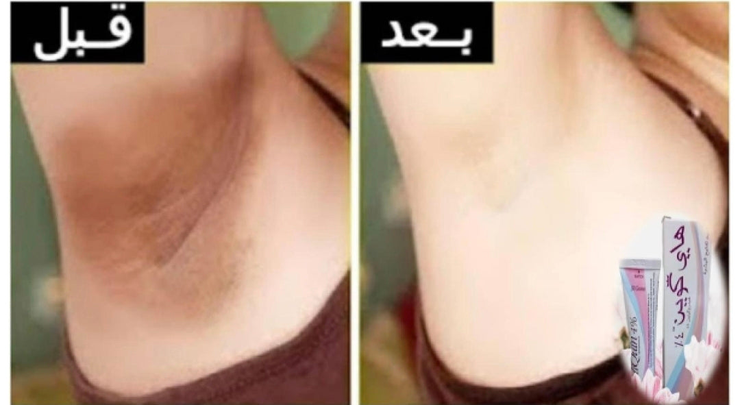 Hi Quin - هاي كوين